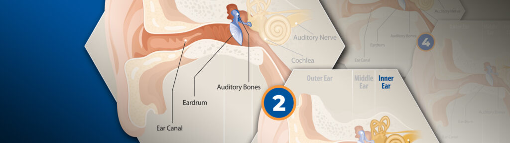 4 Types of Hearing Loss - Trusted provider of solutions for individuals ...